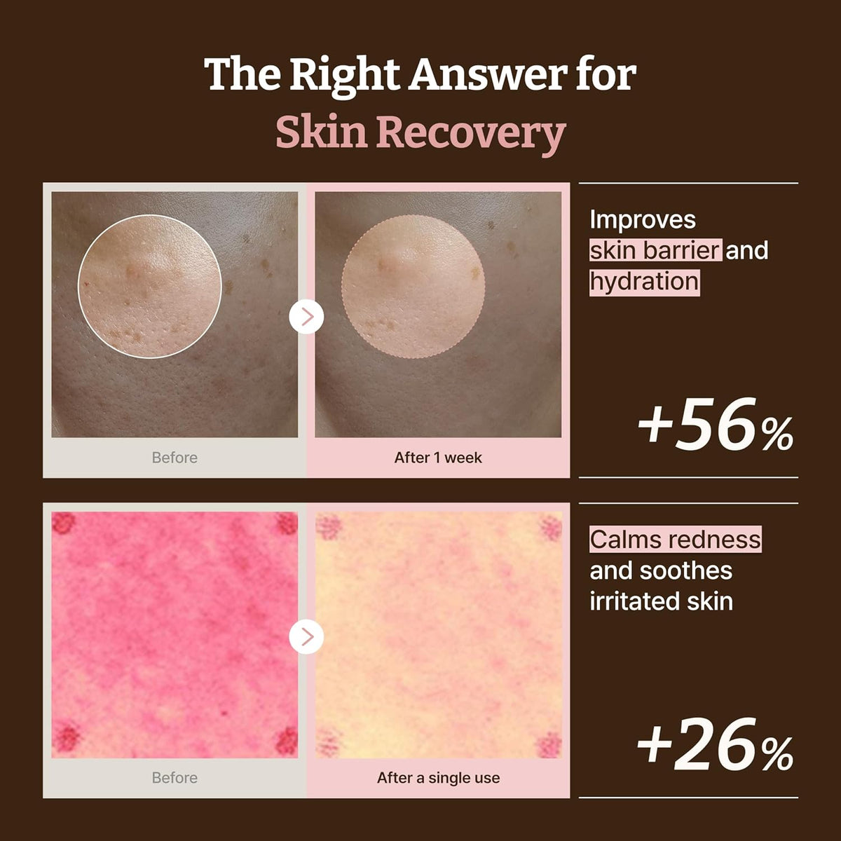 Dr.Reju-All Advanced PDRN Rejuvenating Cream – 99% Pure Salmon DNA Gel Type Face Moisturiser – Optimal 1200ppm for Glass Skin & Plumping – Korean Pharmacy Anti-Aging Skin Care Face Cream - 20ml