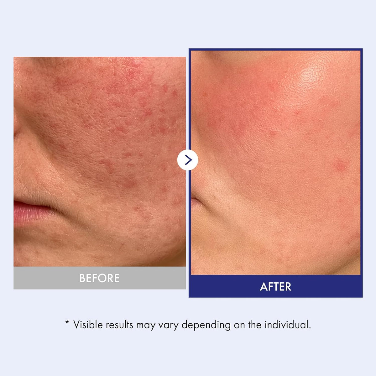 Skin Care 50 ml