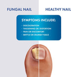 Fungal Shield Max Strength Brush-On Antifungal Liquid, 2-Pack | 2-pack brush-on antifungal liquid for max strength fungal relief, precise no-mess application