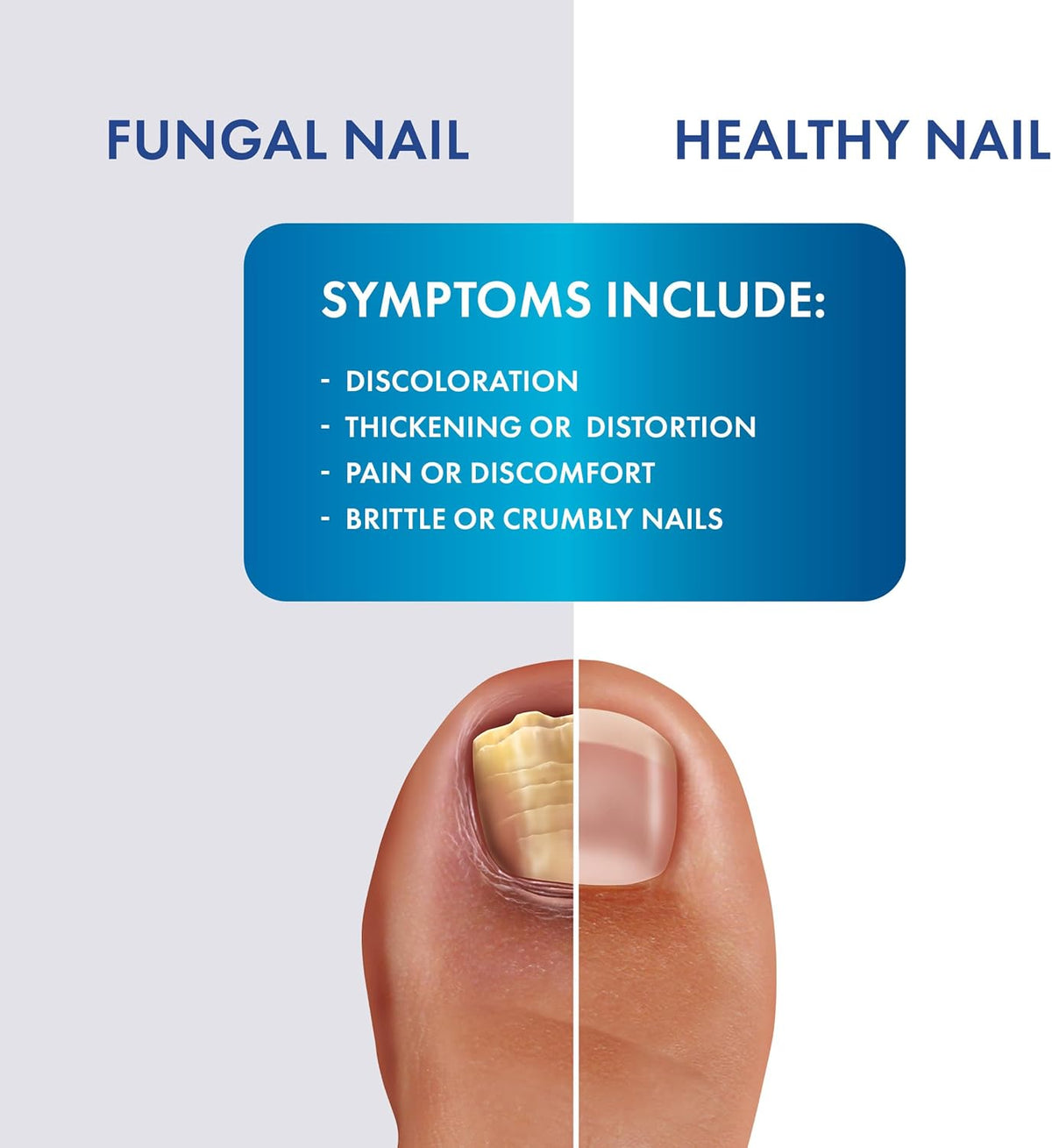 Fungal Shield Max Strength Brush-On Antifungal Liquid, 2-Pack | 2-pack brush-on antifungal liquid for max strength fungal relief, precise no-mess application