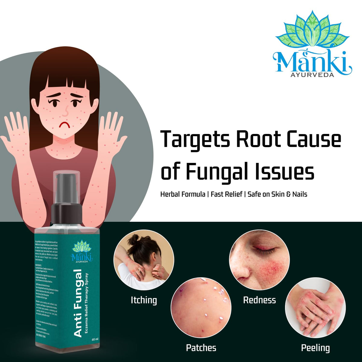 Herbal Anti Fungal Spray | Skin Care Spray for Itching, Odour & Irritation | Natural Ingredients | Suitable for Feet, Underarms & Body | 60ml