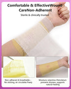 Xeroform Petrolatum Dressing 2"x2" Pack of 25, Non Stick Pads for Wounds, Non-Adherent Gauze, Fine Mesh Sterile for Wound Care, Burns, Lacerations, Skin Grafts & Surgical Incisions