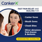 Canker-X Mouth Sore Gel, Fast Pain Relief, Benzocaine-Free, 0.28 Fl Oz | Heals Canker Sores, Cheek Bites & Oral Abrasions, Alcohol-Free, Adults & Kids 6+ Years