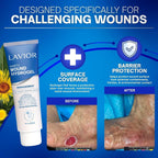 LAVIOR Diabetic Wound Hydrogel 1 oz – Hydrogel Dressing for Wounds, Cuts, Scrapes, CGM Sites & Minor Skin Injuries – Botanical Formula – Vegan – Made in USA