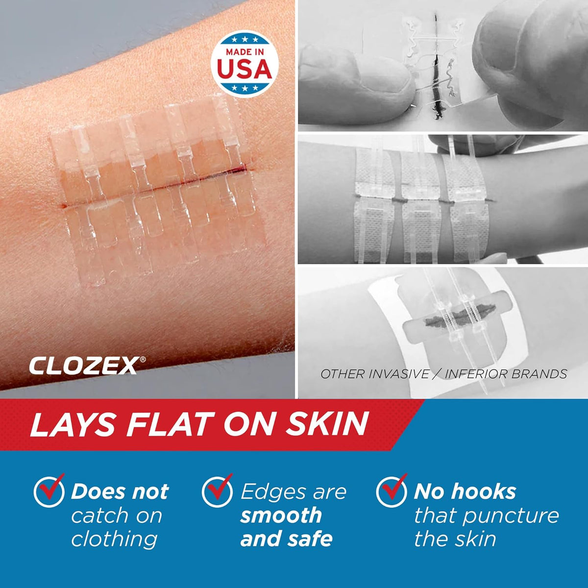 Clozex Emergency Laceration Closure Only- Close Wounds Without Stitches with This Surgical-Grade Skin Device. Available in 3 Variations for Wounds up to 1.0” or 3.5”. Life Happens, Be Ready!