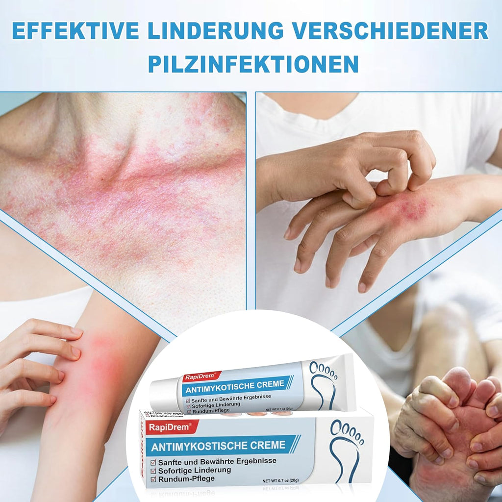 Antifungal Treatments 20g