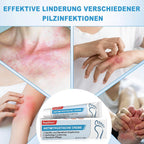 Antifungal Treatments 20g