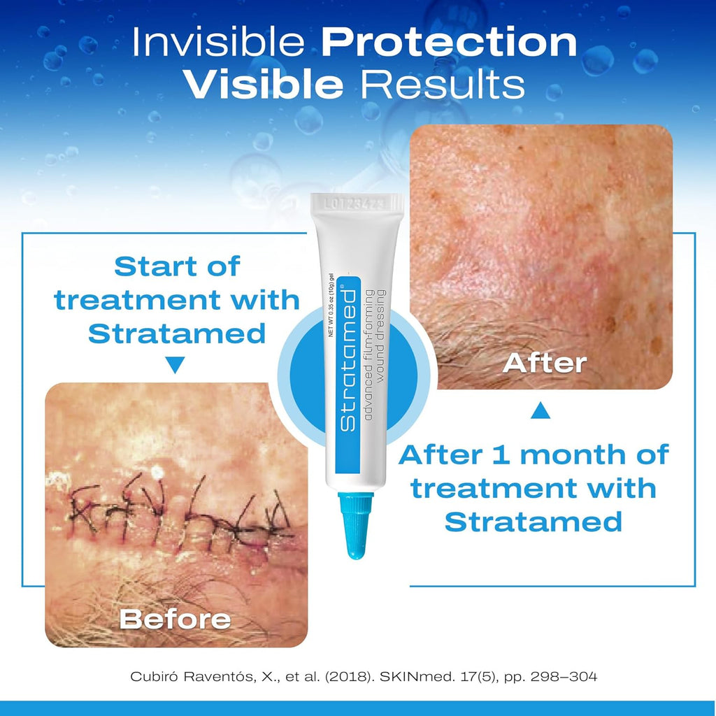 Gauze and Wound Dressings