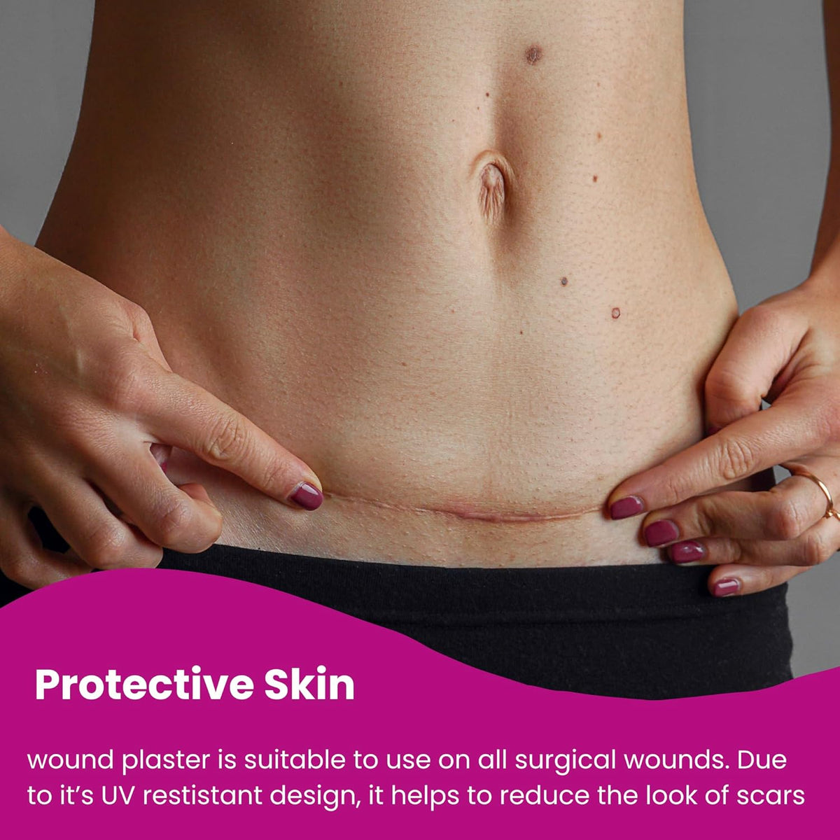 Protective Wound Care Supplies Breathable Silicone 25 cm 10 pieces