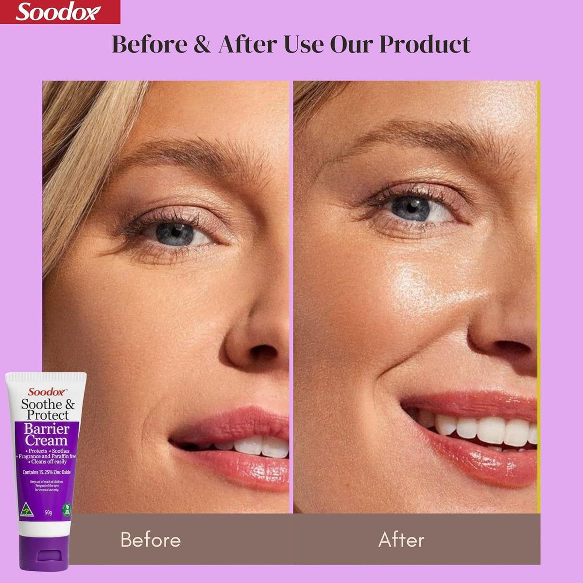 Soodox Soothe & Protect Barrier Cream 50g – 15.25% Zinc Oxide Nappy Rash & Skin Barrier Cream for Babies, Children & Adults, Sensitive Skin, Fragrance Free, Australian Made & Owned