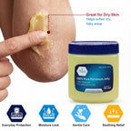 MED PRIDE 100% Pure White Petroleum Jelly, Skin Protectant, 8 oz, Unscented