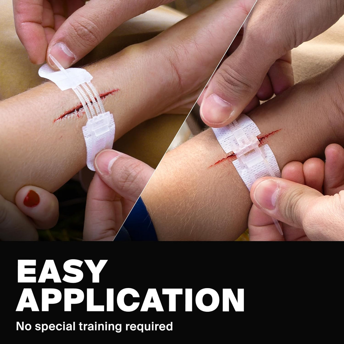 Zip Stitch Wound Closure Strips - Repair Wounds Without Stitches - Zipstitch Sutures - Laceration Closure First Aid Kit