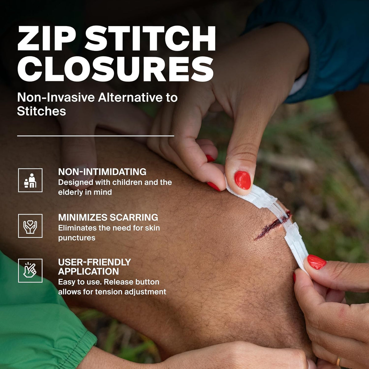 SurviveX Zip Stitch Wound Closures - No Stitches Needed, 3 Pieces | Close wounds without needles or stitches, Non-invasive for sensitive users, Easy to use, Adjustable tension