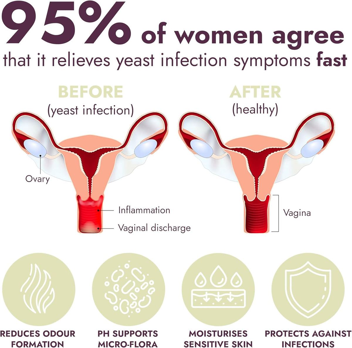 Terramed Just Think Comfort Yeast Infection Treatment for Women | Ph Balance for Women | Helps Relieve Itching & Irritation | Vaginal Aid for Inflammation, Dryness & Watery Discharge | 7 Count