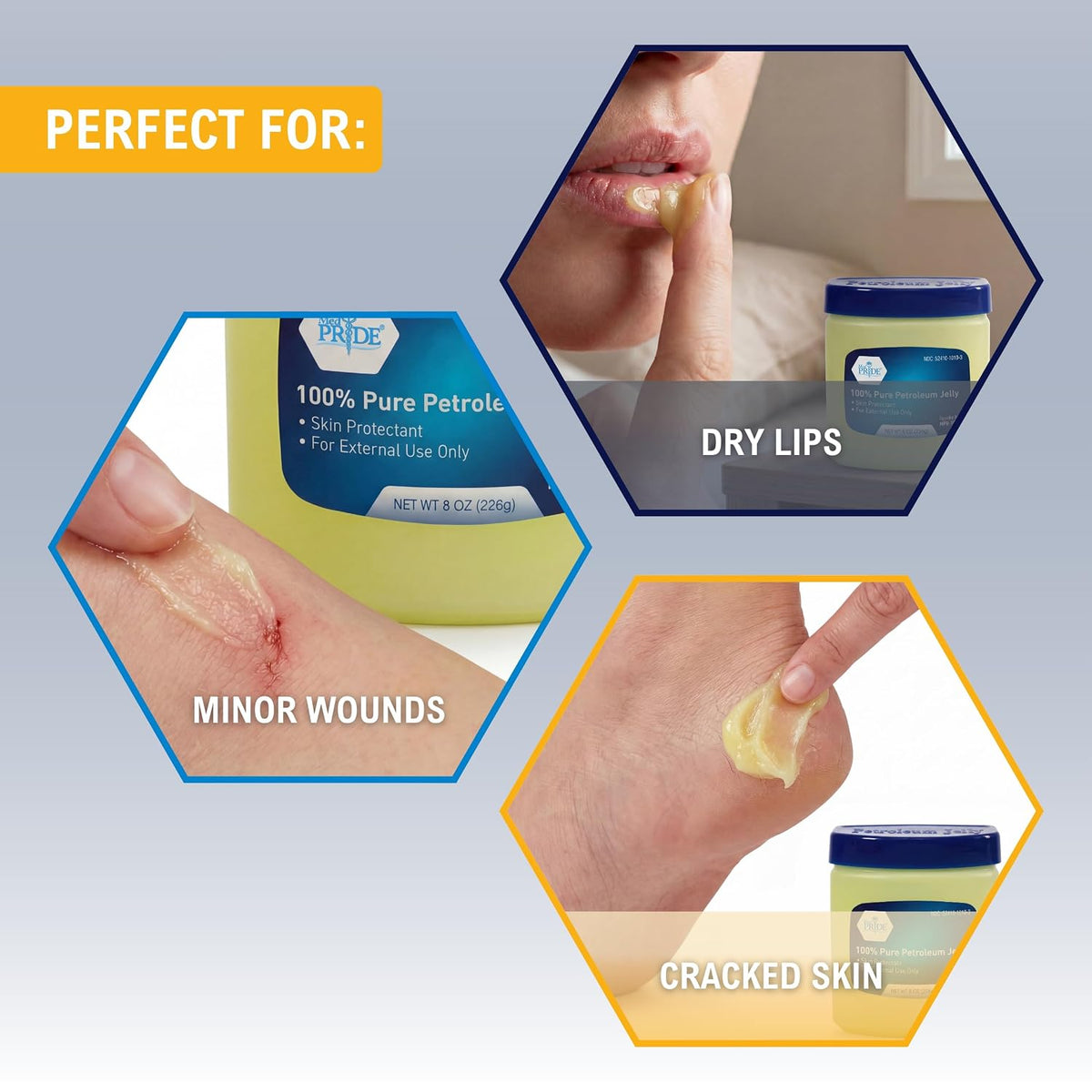 MED PRIDE 100% Pure White Petroleum Jelly, Skin Protectant, 8 oz, Unscented