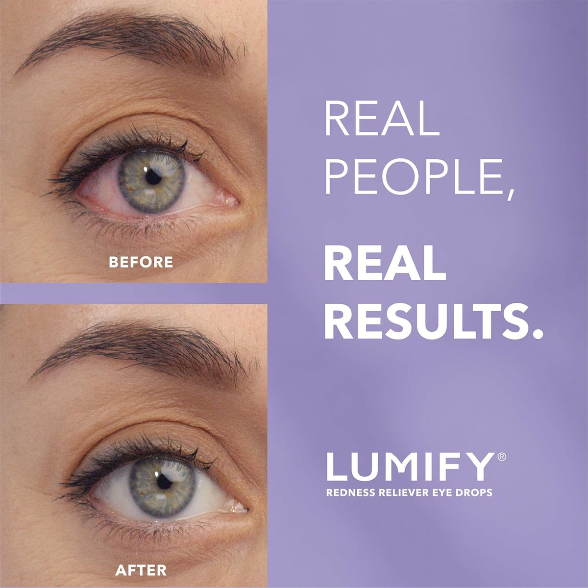 LUMIFY Redness Reliever Eye Drops, for Whiter & Brighter Looking Eyes, 0.08 Fl Oz (2.5 mL)