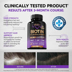 Biotin, Collagen, Hyaluronic Acid & Keratin - Hair Growth Support - 60 Caps | Hair, Skin & Nails Vitamins - Clinically Tested Supplement for Men & Women - 25000mcg Vitamins B1, B2, B3, B6 & B7