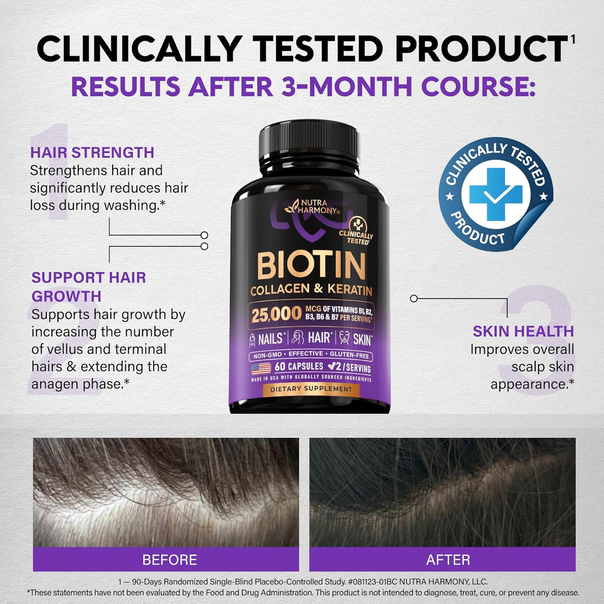 Biotin, Collagen, Hyaluronic Acid & Keratin - Hair Growth Support - 60 Caps | Hair, Skin & Nails Vitamins - Clinically Tested Supplement for Men & Women - 25000mcg Vitamins B1, B2, B3, B6 & B7