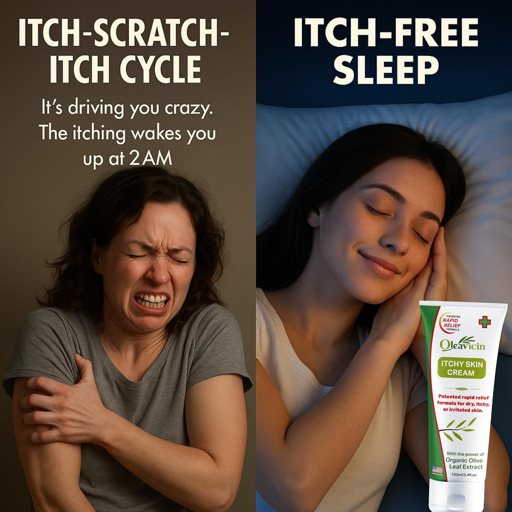 Oleavicin Extra Strength Anti-Itch Cream - Itchy Skin Cream for Fast Itch Relief - Natural Anti Itch Cream for Adults & Kids - Organic Olive Leaf Extract - Steroid-Free Rash Relief for Sensitive Skin