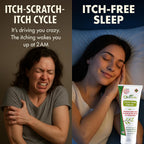 Oleavicin Extra Strength Anti-Itch Cream - Itchy Skin Cream for Fast Itch Relief - Natural Anti Itch Cream for Adults & Kids - Organic Olive Leaf Extract - Steroid-Free Rash Relief for Sensitive Skin