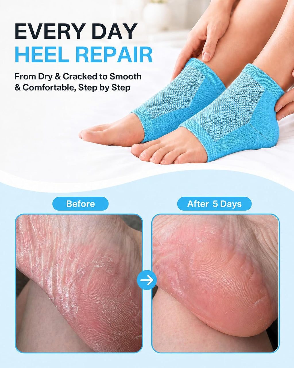 Moisturizing Socks, 100% Cotton Heel Socks for Dry Cracked Feet Women, Cracked Heel Treatment Silicone Heel Socks, Breathable Hydrating Gel Heel Protectors for Repair, Spa & Daily Use