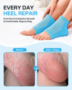 Moisturizing Socks, 100% Cotton Heel Socks for Dry Cracked Feet Women, Cracked Heel Treatment Silicone Heel Socks, Breathable Hydrating Gel Heel Protectors for Repair, Spa & Daily Use