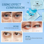 PEAUAMIE Under Eye Patchs Hyaluronic Acid Eye Mask for Dark Circles and Puffiness Wrinkle Eye Bags 30 Pairs