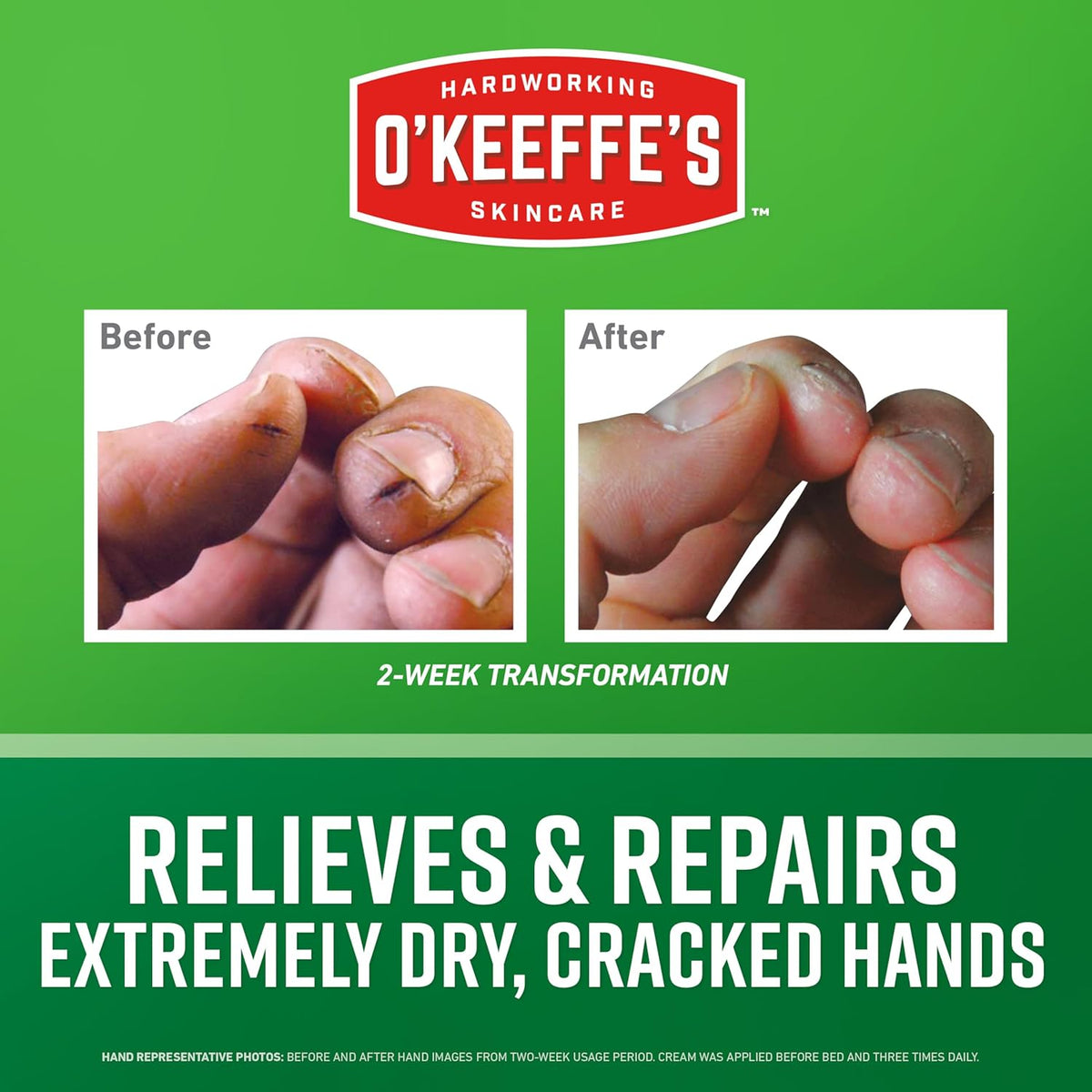 O'Keeffe's Working Hands Cream 76g Jar - Guaranteed Relief for Very Dry Hands. Relieves & Repairs Extremely Dry, Cracked Hands. Tough on Dryness, Gentle on Sensitive Skin. Non-Greasy, Unscented