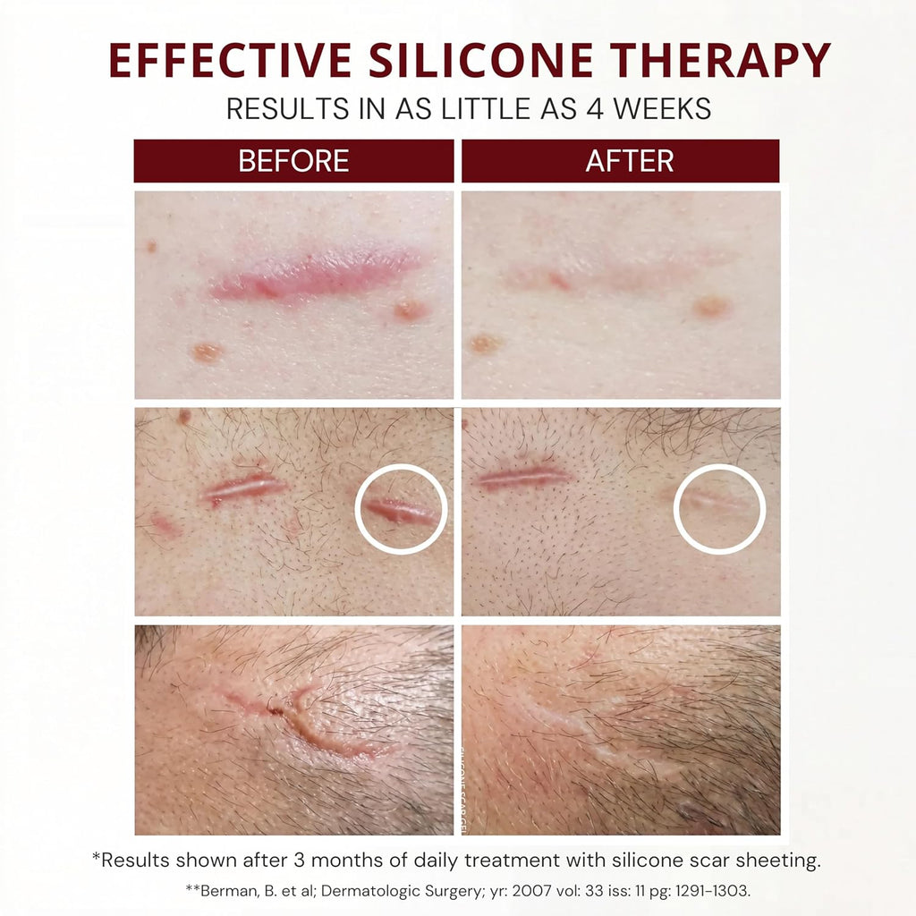 HealFast Silicone Scar Gel - Medical Grade Scar Cream for Surgical Scars