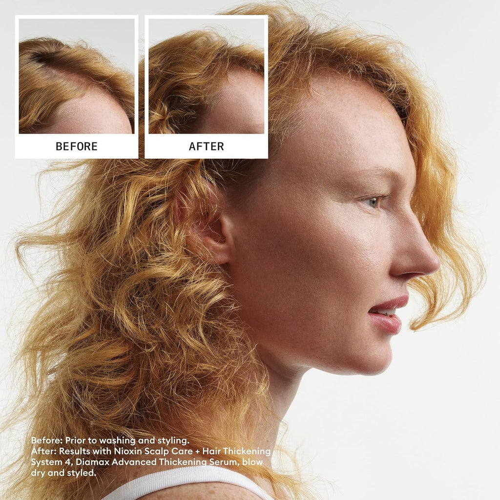 Nioxin Scalp + Hair Thickening System Kits | For Natural, Colored, & Damaged Hair with Light to Progressed Thinning | Strengthen & Boost Hair Density with Niacinamide & Biotin | 3 Month Supply