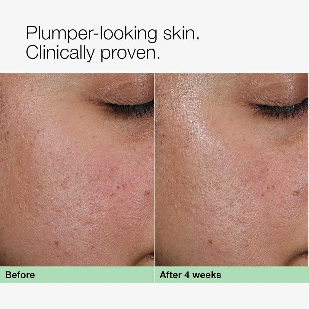 Clinique Smart Clinical Repair Face Cream Moisturizer | Now Available in Collagen + PDRN and Wrinkle Correcting Formulas