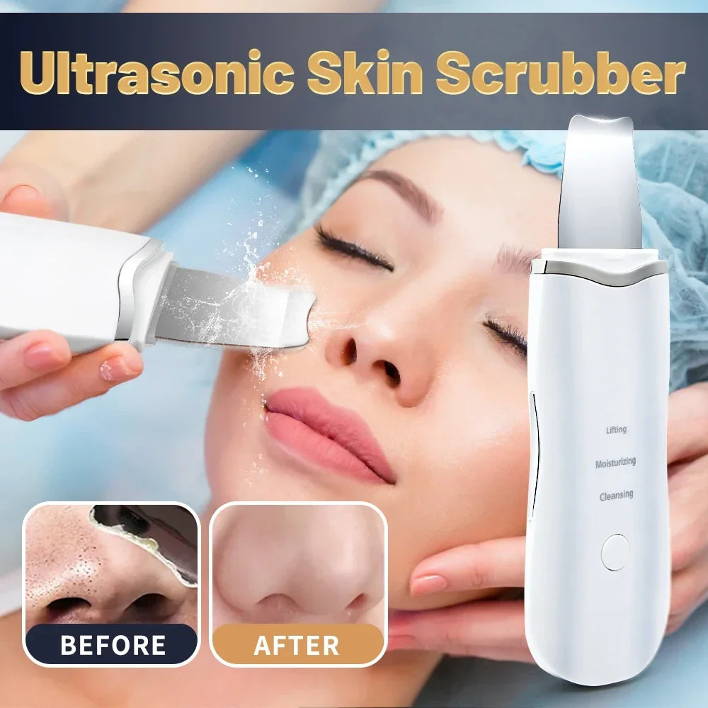 Rechargeable Facial Skin Scrubber — Ion Deep Cleansing