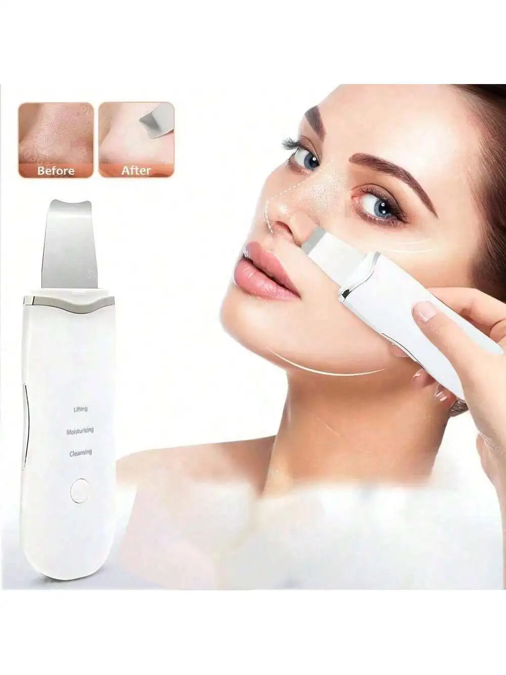 Ultrasonic Skin Scraper — Rechargeable Pore Cleaner