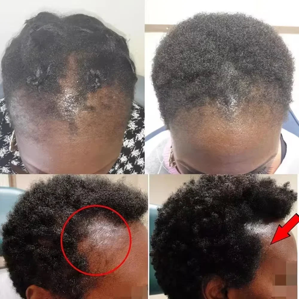 Batana Oil Hair Growth Set with Mask & Hair Oil