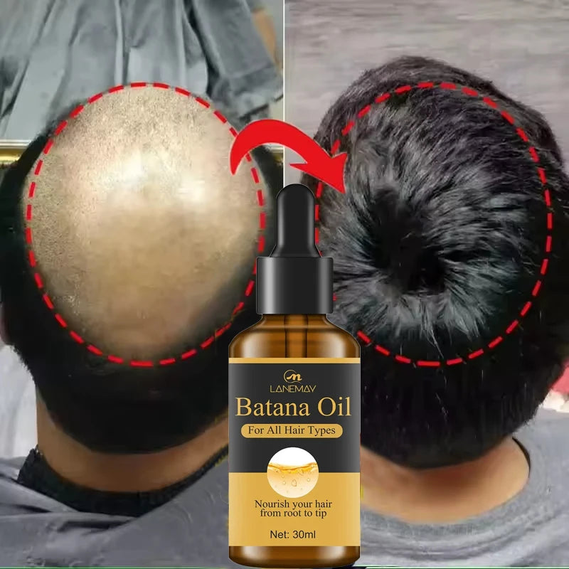 Batana Oil Hair Growth Serum — Anti‑Loss Repair for Women & Men
