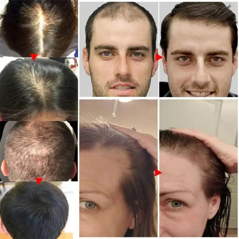 Batana Oil Hair Growth Serum — Anti‑Loss Repair for Women & Men