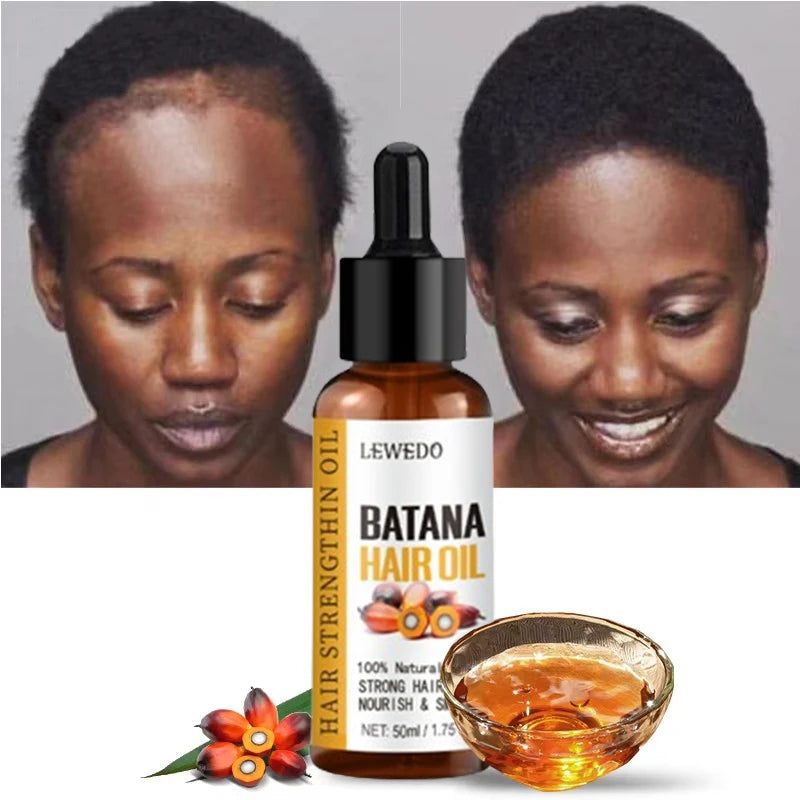 Lewedo Naturals Pure Batana Oil for Hair Nourish & Growth