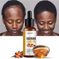 Lewedo Naturals Pure Batana Oil for Hair Nourish & Growth