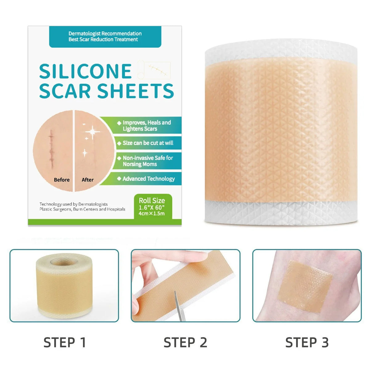 Silicone Scar Tape Roll — 4cm x 1.5m, Self-Adhesive & Reusable
